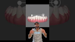 Invisalign Case Planning and Review 2023