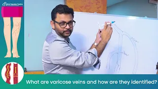 How to  identified Varicose Veins ? | Explained by  Vascular Expert  Dr Rajah V Koppala