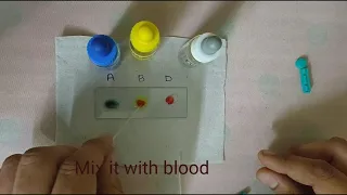 Determination of blood group