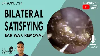 734 - Bilateral Satisfying Ear Wax Removal