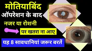 मोतियाबिंद ऑपरेशन के बाद क्या सावधानी रखें | Post Cataract Operation Eye Care -Tips by VikasAgrawal