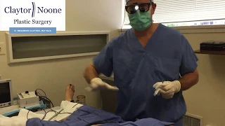 Tummy Tuck Scar Revision | Dr. Claytor Fixes Tummy Tucks Scars | REAL PATIENT FOOTAGE!