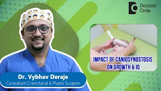 How IQ & Growth Are Affected By Craniosynostosis? #newborn  - Dr. Vybhav Deraje| Doctors' Circle