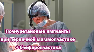 Полиуретановые импланты при первичной маммопластике + пластика век. Съемка с операционного стола