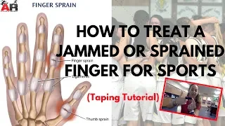 How To Treat a Jammed or Sprained Finger For Sports