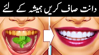 کیا پیلے دانت خشک ہونٹ اور سانس میں بُو سے پریشان ہیں❓Home Remedy#1 to Remove Dental Plaque & Tarter