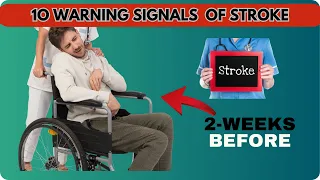 10 Warning Signs of Stroke two weeks Before || Naturally