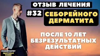 Отзыв #32 | Себорейный дерматит на лице и голове. Лечение у Павла Ястремского