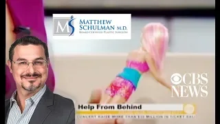 Brazilian Butt Lift - CBS News - Schulman Plastic Surgery