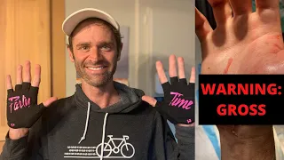 (WARNING GROSS) Why I ALWAYS Wear Gloves on the Bike - The Crash I Didn't Tell You About Last Year