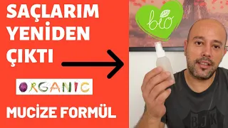 Saçlarım Yeniden Çıktı l Saç Çıkaran Mucize Doğal Kür l Saç Dökülmesine Karşı Çözüm l Son Durum l