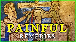 Top 5 Most PAINFUL Medieval Surgical & Medical Treatments!