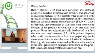 Почерников Д Г - Обструктивный простатит
