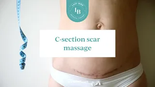 C-Section Scar Massage