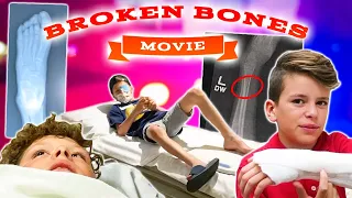 MOVIE ABOUT BROKEN BONES | YEARS OF BROKEN BONES AND X-RAYS