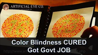 Color Blindness treatment for my brother after My Color Blindness was cured