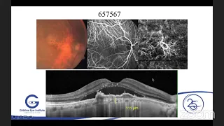 AIOS ARC Enhancing Concepts   OCT & OCT...  Dr  A  GIRIDHAR