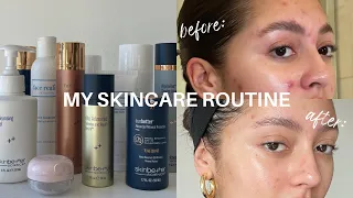 My Morning & Night Skincare Routine | Cystic, Hormonal Acne | Sloan Byrd