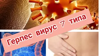 ГЕРПЕС ВИРУС 7 ТИПА ЛЕЧИТСЯ/КИШЕЧНИК/Мой опыт/Без таблеток/