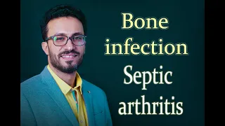 04 Bone infection: Septic arthritis