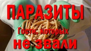 Паразиты внутри человека.  Важно знать!!! Впечатлительным смотреть не стоит.