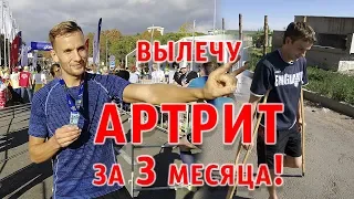 Ревматоидный артрит | Лечение