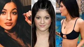 Kylie Jenner Plastic Surgey Then and Now 2018