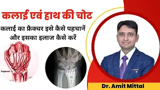 कलाई की हड्डी टूटना | Wrist Fracture | Scaphoid Fracture | Wrist Fracture Exercise in Hindi