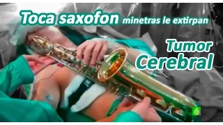 Extraen tumor cerebral mientras toca música - sonata de la vida