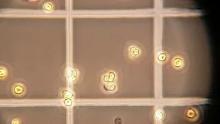 Chlorella au microscope