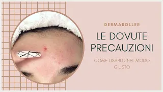 DERMAROLLER E MICRONEEDLING || COME USARLO IN CASA SENZA PROBLEMI