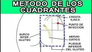 🔴 INYECTOTERAPIA METODO DE LOS CUADRANTES (VIA INTRAMUSCULAR) - 2021