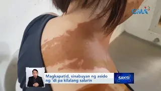 Magkapatid, sinabuyan ng asido ng 'di pa kilalang salarin | Saksi