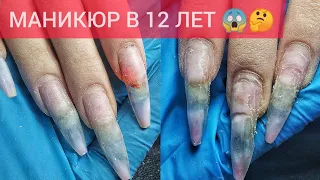 УБИЛА НОГТИ В 12 ЛЕТ 🤕😱 СЛОЖНАЯ КОРРЕКЦИЯ👷🤯