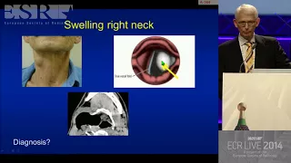 H&N E³ 720a   Pitfalls in head and neck imaging 1