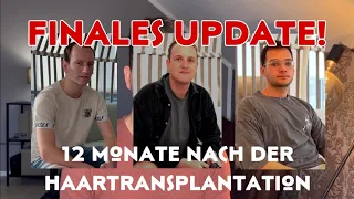 KRASSE ERGEBNISSE! - So sehen Heiko, Christoph und Kaan 1 Jahr nach ihrer Haartransplantation aus!