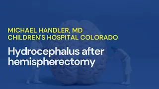 Hydrocephalus after hemispherectomy