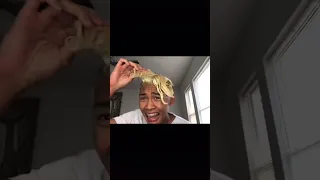 Guy's Hair Falls out After Bleaching #shorts