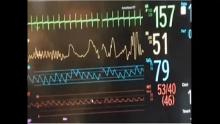 neonatal hemodynamics