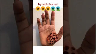 Trypophobia Test 😖 || Rare Short 🤮 || trypophobia real test || irration 😵