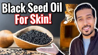 How to Use Black Seed Oil for Acne Scars, Eczema, and Wrinkles