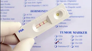 Was bringt der PSA-Test zur Prostatakrebs-Vorsorge wirklich? | Marktcheck SWR