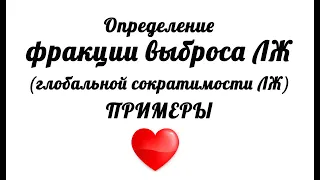 ЭхоКГ. Определение фракции выброса левого желудочка. Глобальная сократимость ЛЖ.