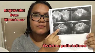 ENGRAVIDEI COM OVÁRIOS POLICÍSTICOS E SEM MENSTRUAR..