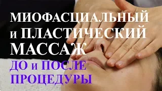 Остеопатический и пластический массаж. Лицо до и после процедуры. Омоложение лица