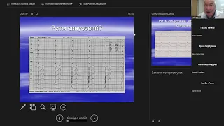 Оформлення ЕКГ-висновку