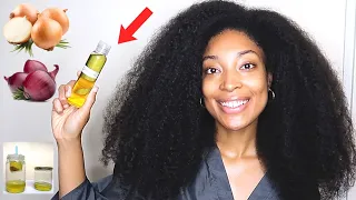 2 WAYS TO MAKE ONION OIL FOR MASSIVE HAIR GROWTH | HOW TO USE ONION OIL FOR EXTREME HAIR GROWTH