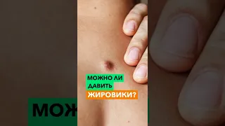 Можно ли давить жировики?