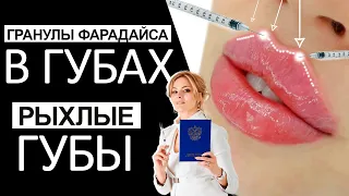 Гранулы Фарадайса в губах/ Рыхлые губы / Увеличение губ / Видео-урок от преподавателя