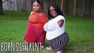 Living Without Limbs Brought Us Together | BORN DIFFERENT